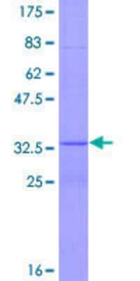 SDS-PAGE: Recombinant Human IRE1 alpha GST (N-Term) Protein [H00002081-P01]