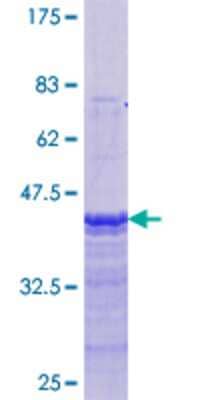 SDS-PAGE: Recombinant Human ER alpha/NR3A1 GST (N-Term) Protein [H00002099-Q01]