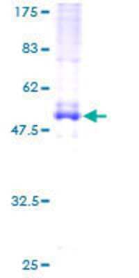 SDS-PAGE: Recombinant Human EVI2A GST (N-Term) Protein [H00002123-P01]