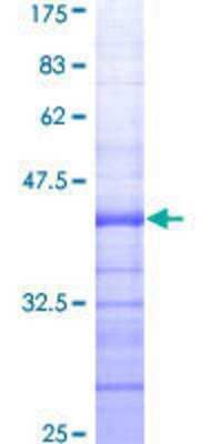 SDS-PAGE: Recombinant Human EZH2/KMT6 GST (N-Term) Protein [H00002146-Q01]