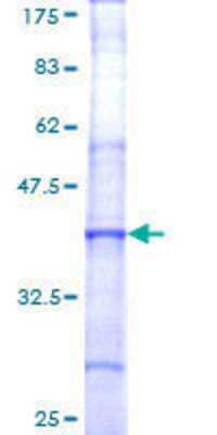 SDS-PAGE: Recombinant Human Factor V GST (N-Term) Protein [H00002153-Q01]