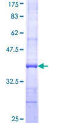 SDS-PAGE: Recombinant Human Factor VIII GST (N-Term) Protein [H00002157-Q01]