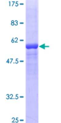 SDS-PAGE: Recombinant Human Factor XII heavy chain GST (N-Term) Protein [H00002161-P01]