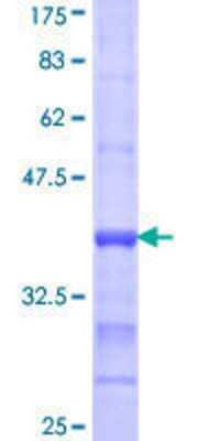 SDS-PAGE: Recombinant Human ACSL1 GST (N-Term) Protein [H00002180-Q01]