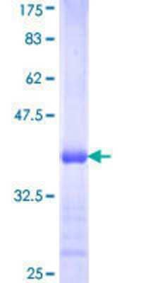 SDS-PAGE: Recombinant Human ACSL3 GST (N-Term) Protein [H00002181-Q01]