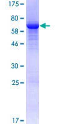 SDS-PAGE: Recombinant Human Fumarylacetoacetate hydrolase GST (N-Term) Protein [H00002184-P01]