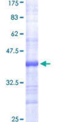 SDS-PAGE: Recombinant Human Fatty Acid Synthase/FASN GST (N-Term) Protein [H00002194-Q01]