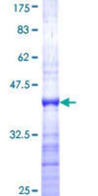 SDS-PAGE: Recombinant Human FOXG1 GST (N-Term) Protein [H00002290-Q01]