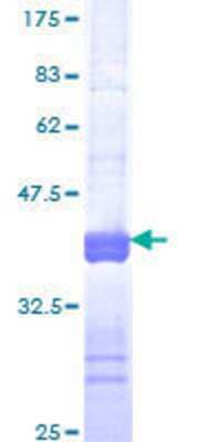 SDS-PAGE: Recombinant Human FMRP GST (N-Term) Protein [H00002332-Q01]