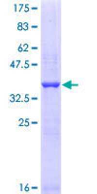 SDS-PAGE: Recombinant Human FSHR GST (N-Term) Protein [H00002492-Q01]