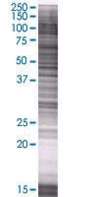 Other: Polypeptide GalNac Transferase 1/GALNT1 293T Cell Transient Overexpression Lysate [H00002589-T01]