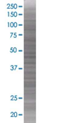 Other: Polypeptide GalNac Transferase 3/GALNT3 293T Cell Transient Overexpression Lysate [H00002591-T01]