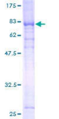 SDS-PAGE: Recombinant Human GK3P GST (N-Term) Protein [H00002713-P01]