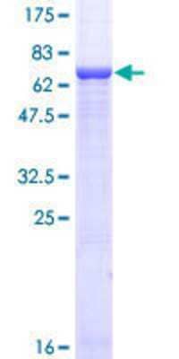 SDS-PAGE: Recombinant Human G protein alpha GST (N-Term) Protein [H00002778-P01]