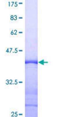 SDS-PAGE: Recombinant Human GM130/GOLGA2 GST (N-Term) Protein [H00002801-Q01]