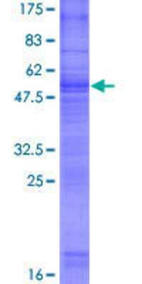 SDS-PAGE: Recombinant Human GPM6B GST (N-Term) Protein [H00002824-P01]