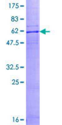 SDS-PAGE: Recombinant Human CCR10/GPR2 GST (N-Term) Protein [H00002826-P01]