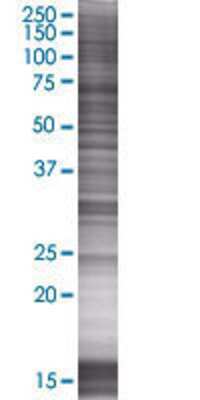 Other: GSTZ1 293T Cell Transient Overexpression Lysate [H00002954-T01]