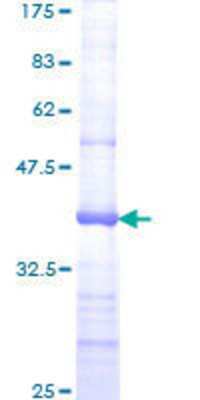 SDS-PAGE: Recombinant Human MSH6 GST (N-Term) Protein [H00002956-Q01]