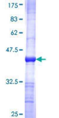 SDS-PAGE: Recombinant Human Guanylyl Cyclase alpha 2 GST (N-Term) Protein [H00002977-Q01]