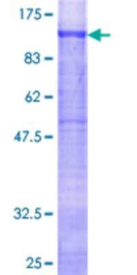 SDS-PAGE: Recombinant Human Glycogen Synthase GST (N-Term) Protein [H00002997-P01]