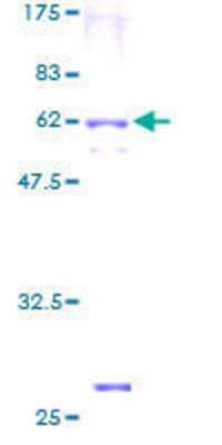 SDS-PAGE: Recombinant Human Hyaluronan Synthase 3/HAS3 GST (N-Term) Protein [H00003038-P01]