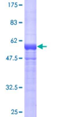 SDS-PAGE: Recombinant Human HGD GST (N-Term) Protein [H00003081-P01]