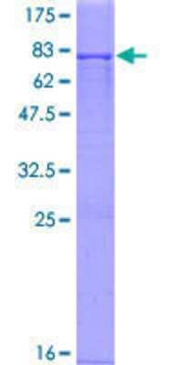 SDS-PAGE: Recombinant Human HGD GST (N-Term) Protein [H00003081-P02]