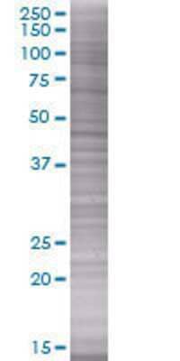 Other: MHC Class I 293T Cell Transient Overexpression Lysate [H00003133-T01]