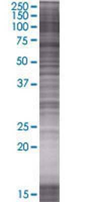 Other: HMG-CoA Reductase/HMGCR 293T Cell Transient Overexpression Lysate [H00003156-T01]