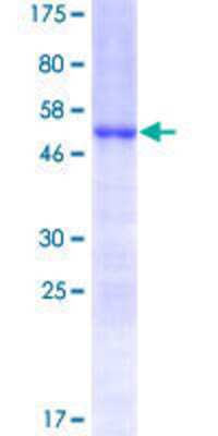 SDS-PAGE: Recombinant Human HOXC6 GST (N-Term) Protein [H00003223-P01]