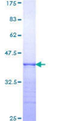 SDS-PAGE: Recombinant Human Integrin alpha 6/CD49f GST (N-Term) Protein [H00003655-Q01]