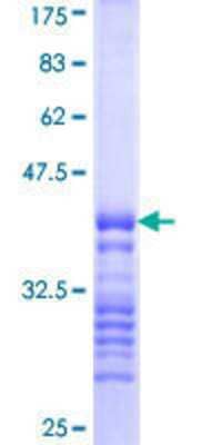 SDS-PAGE: Recombinant Human IRAK2 GST (N-Term) Protein [H00003656-Q01]