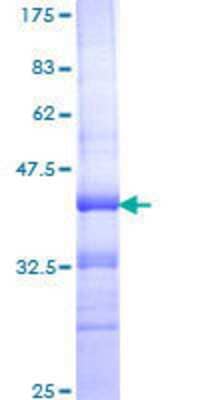 SDS-PAGE: Recombinant Human Integrin alpha 4/CD49d GST (N-Term) Protein [H00003676-Q01]