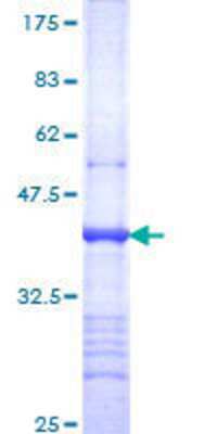 SDS-PAGE: Recombinant Human Integrin alpha 9 GST (N-Term) Protein [H00003680-Q01]