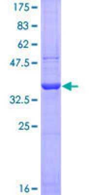 SDS-PAGE: Recombinant Human Integrin alpha D/CD11d GST (N-Term) Protein [H00003681-Q01]