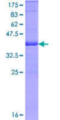 SDS-PAGE: Recombinant Human Integrin alpha E/CD103 GST (N-Term) Protein [H00003682-Q01]