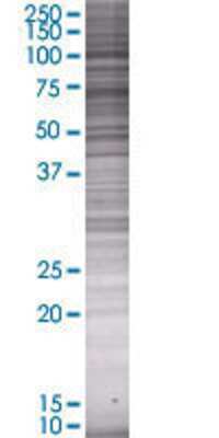 Other: Integrin beta 8 293T Cell Transient Overexpression Lysate [H00003696-T01]