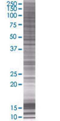 Other: ITPKB 293T Cell Transient Overexpression Lysate [H00003707-T01]