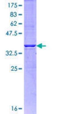 SDS-PAGE: Recombinant Human IP3R1 GST (N-Term) Protein [H00003708-Q01]