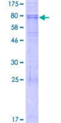 SDS-PAGE: Recombinant Human KCNJ1 GST (N-Term) Protein [H00003758-P01]