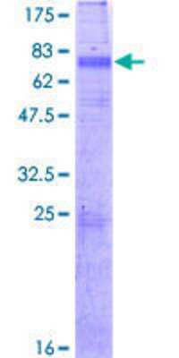 SDS-PAGE: Recombinant Human KCNN3 GST (N-Term) Protein [H00003782-P02]