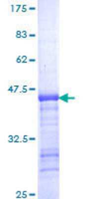 SDS-PAGE: Recombinant Human Eg5 GST (N-Term) Protein [H00003832-Q01]