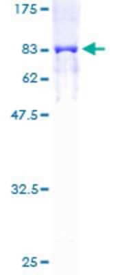 SDS-PAGE: Recombinant Human Cytokeratin 6b GST (N-Term) Protein [H00003854-P01]