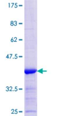 SDS-PAGE: Recombinant Human LAD1 GST (N-Term) Protein [H00003898-Q01]