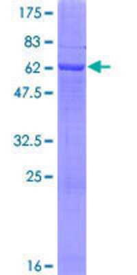 SDS-PAGE: Recombinant Human Lactate Dehydrogenase C GST (N-Term) Protein [H00003948-P01]