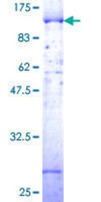 SDS-PAGE: Recombinant Human LIM Kinase 1 GST (N-Term) Protein [H00003984-P01]