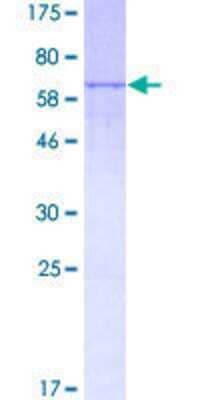 SDS-PAGE: Recombinant Human Lipase A GST (N-Term) Protein [H00003988-P01]