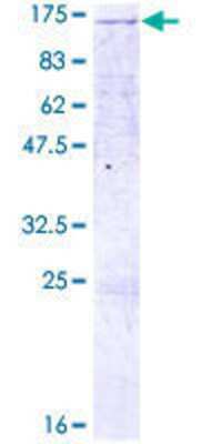 SDS-PAGE: Recombinant Human LLGL2 GST (N-Term) Protein [H00003993-P01]