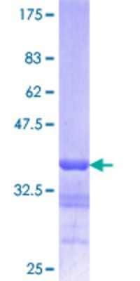 SDS-PAGE: Recombinant Human Lamin B1 GST (N-Term) Protein [H00004001-Q01]